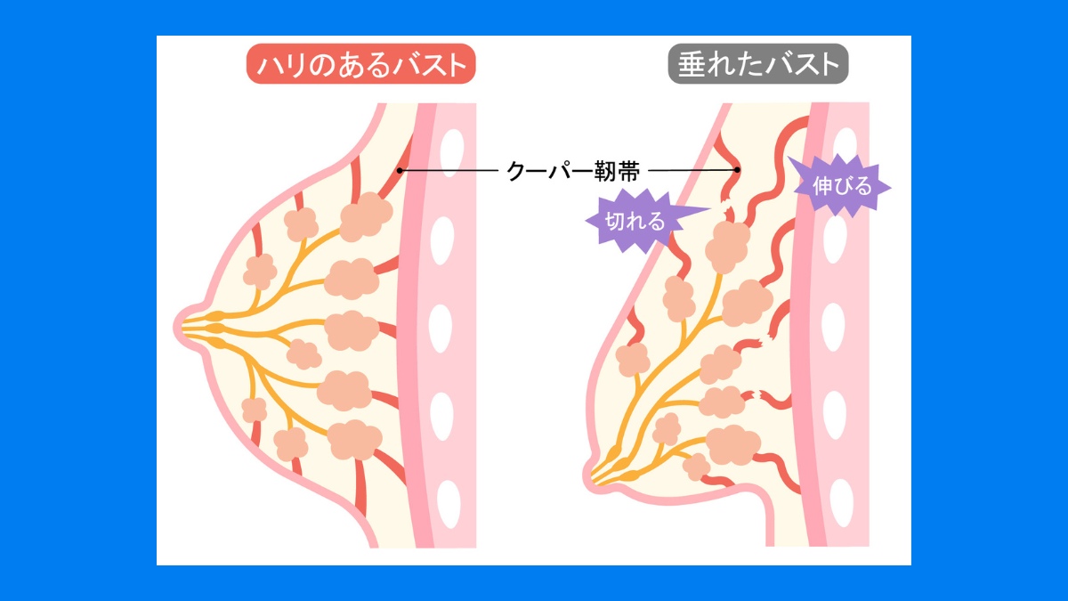 クーパー靭帯